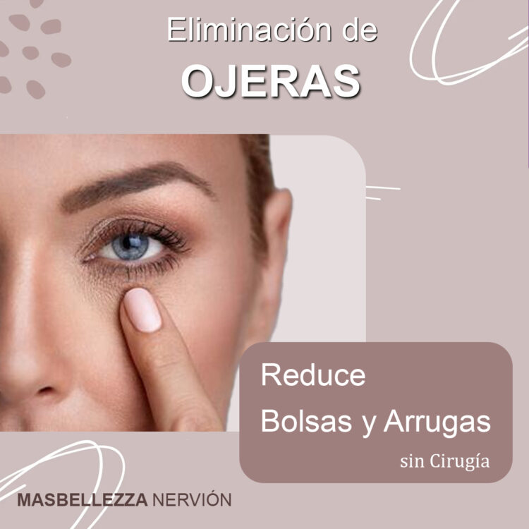 Eliminación de las Ojeras